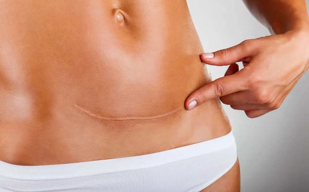 Medizinisches Permanent Make Up zur Narbenbehandlung Medizinisches Permanent Make Up zur Narbenbehandlung